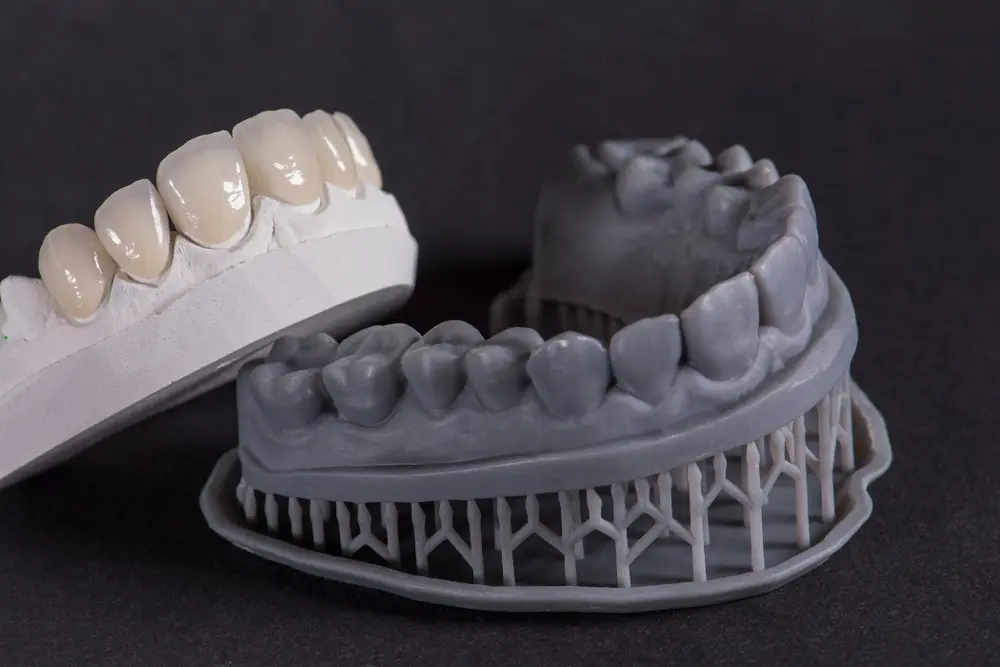 Die Zukunft des Zahnersatzes: 3D-Druck und Bioengineering